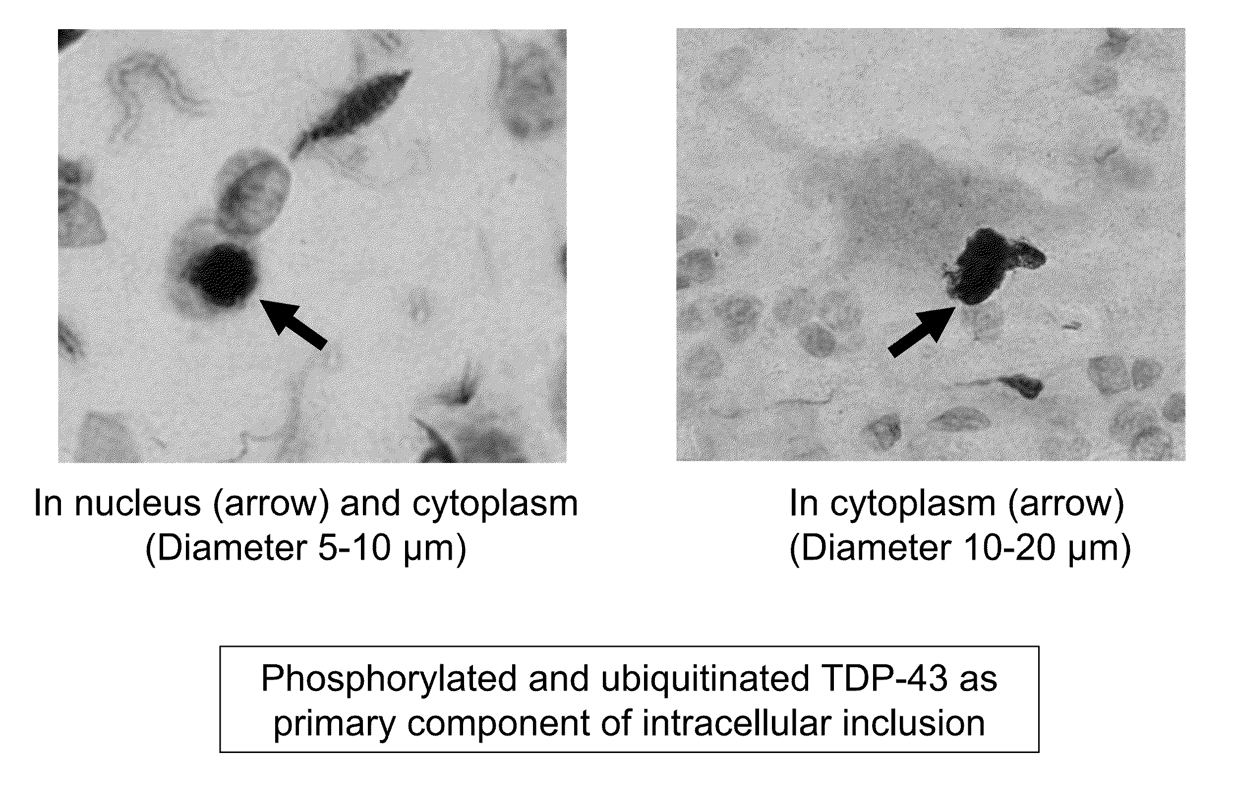 Tdp-43-storing cell model