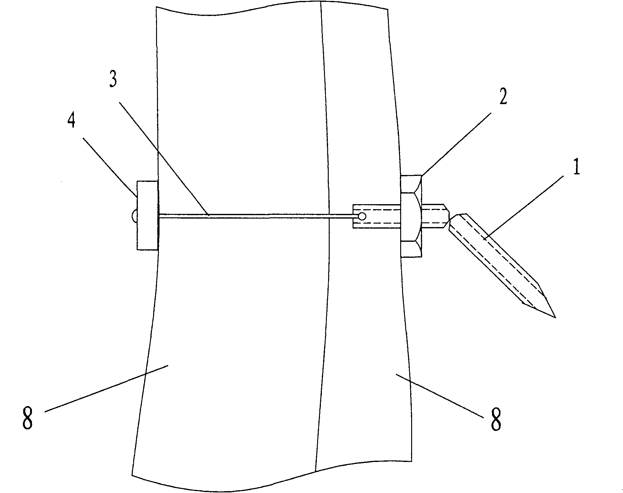 Flexible fixing device for orthopedics