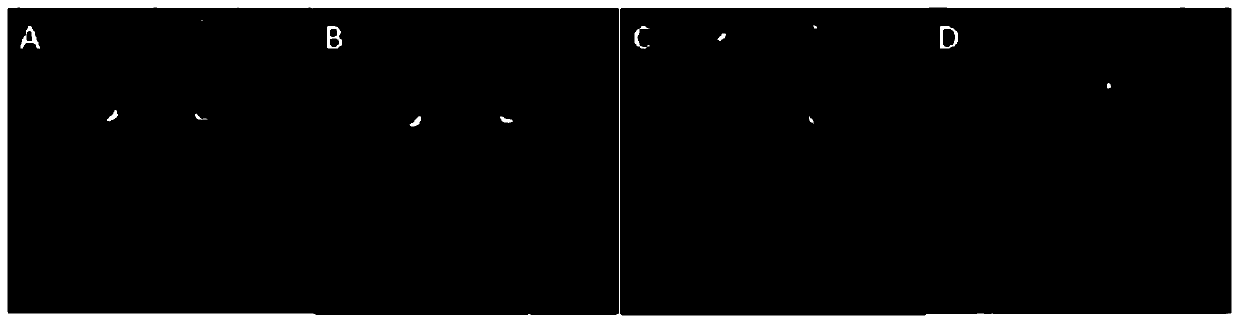 Image distortion correction method based on single-scanning mixed space-time coding magnetic resonance imaging