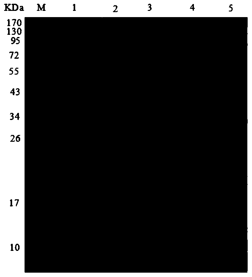 E.maxima nanometer subunit vaccine and preparation method and application thereof