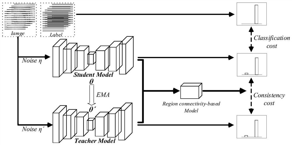 Cerebrovascular image segmentation method based on semi-supervised learning