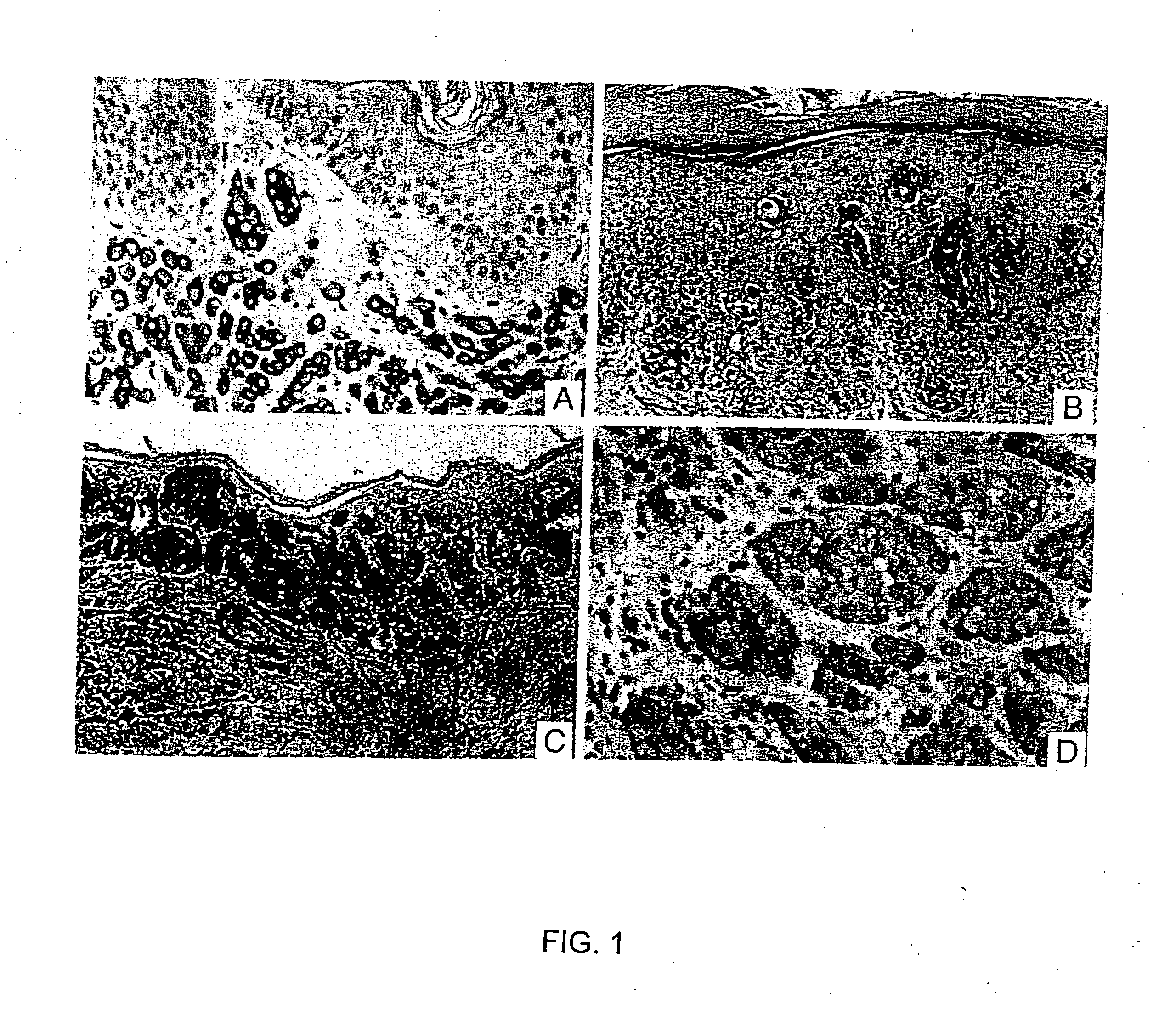 Method and composition for diagnosis of melanocytic lesions