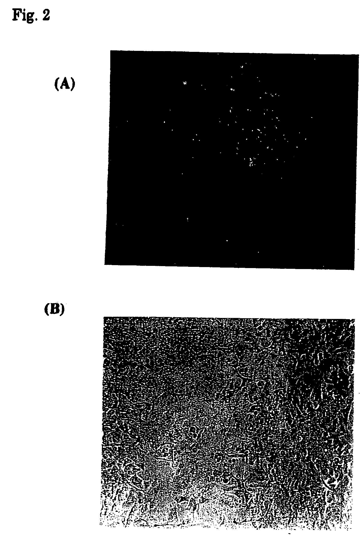 Baculovirus vector vaccine