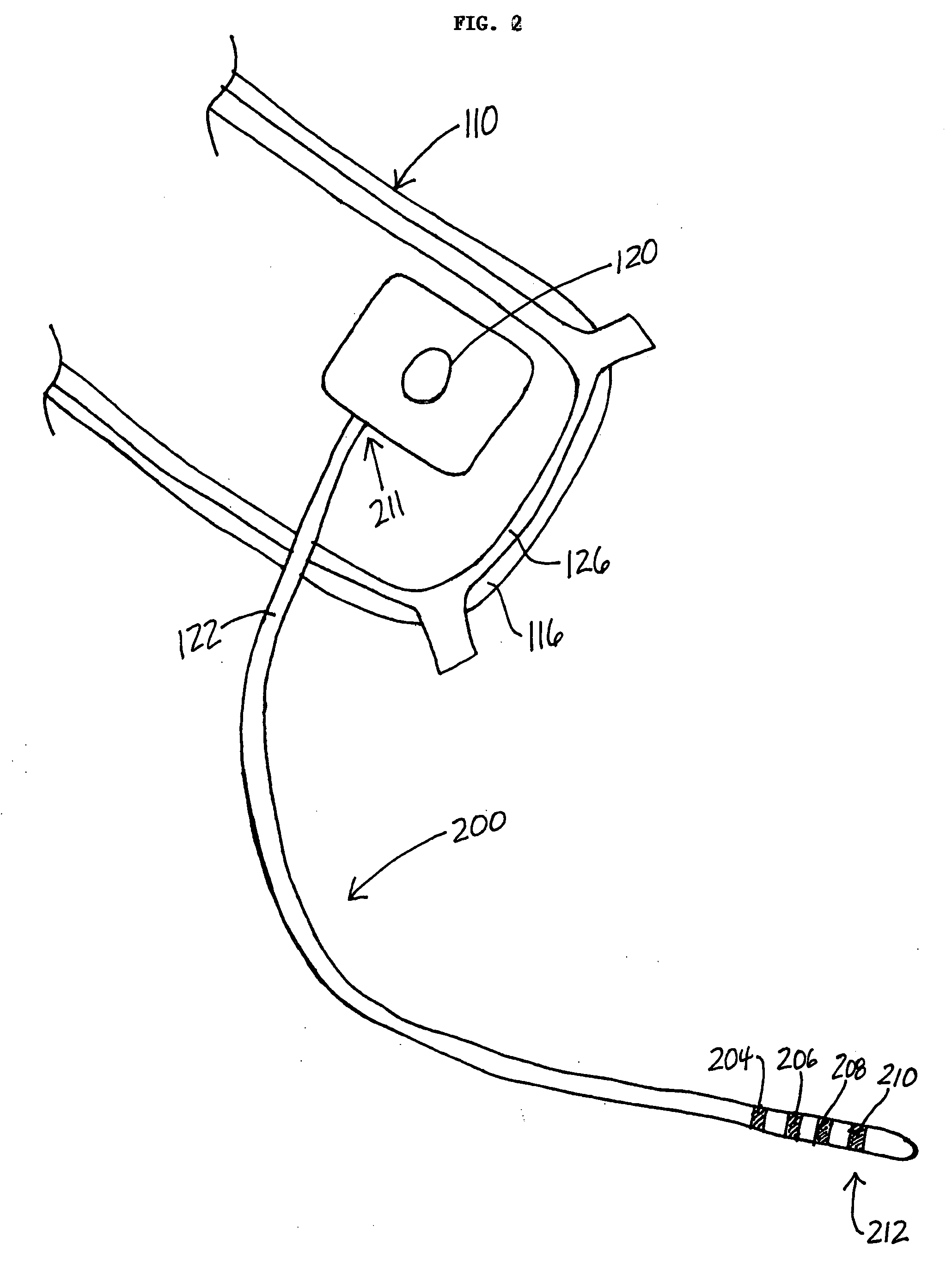 Drug eluting lead systems