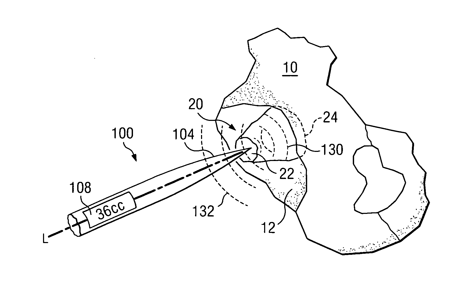 Surgical instrument to assess tissue characteristics