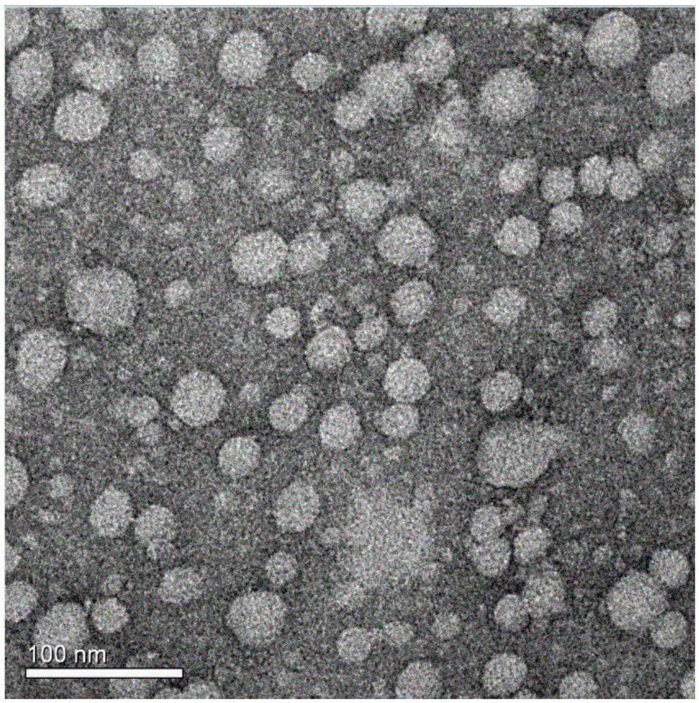 Preparation of brain-targeted bionic nano-drug delivery system and application thereof to brain glioma treatment