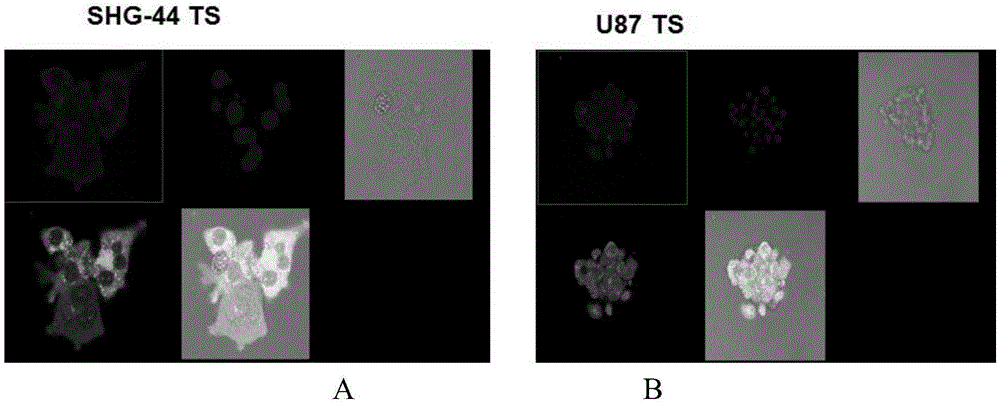 Preparation of brain-targeted bionic nano-drug delivery system and application thereof to brain glioma treatment