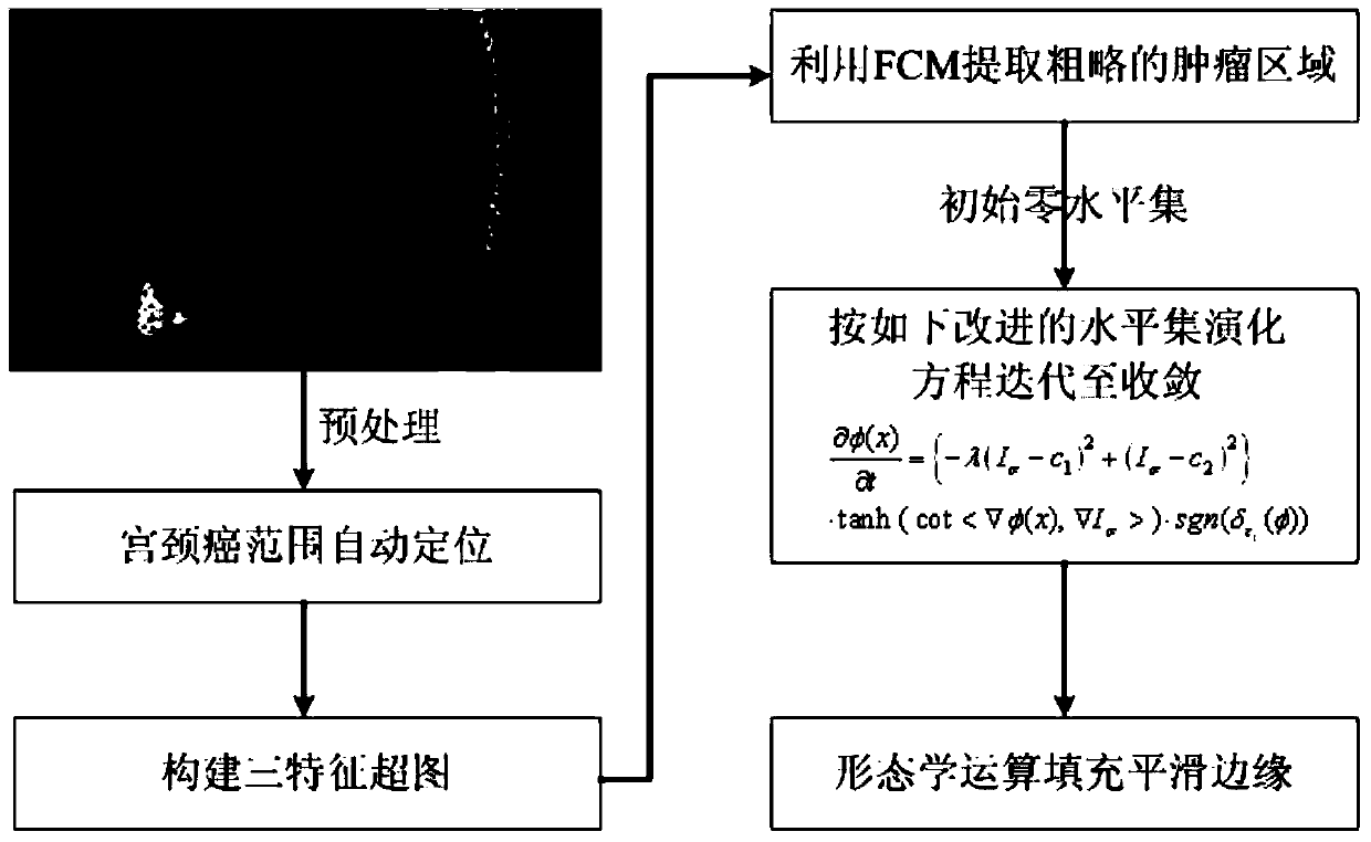 Automatic tumor image region segmentation method based on improved level set