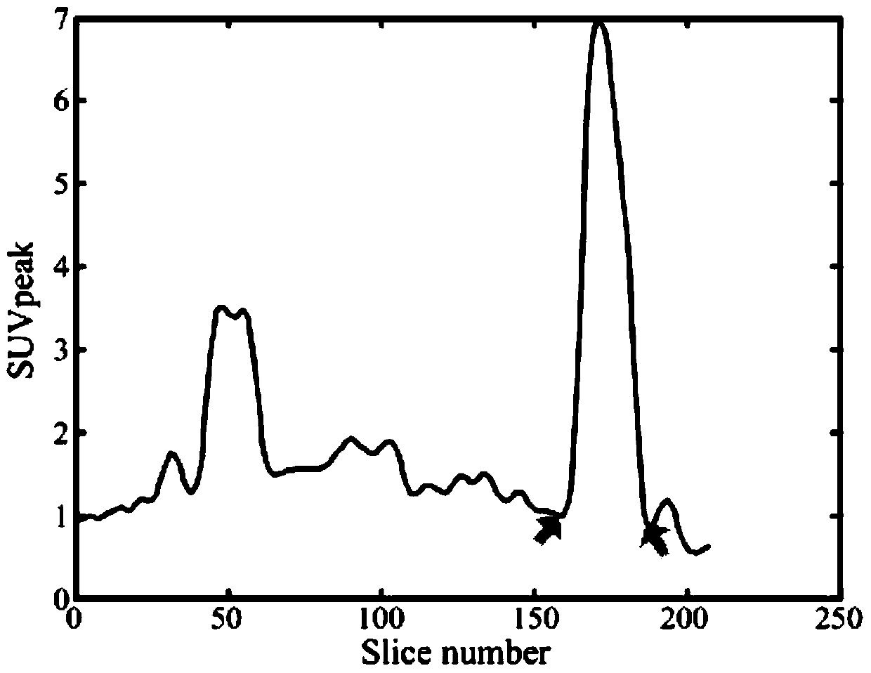 Automatic tumor image region segmentation method based on improved level set