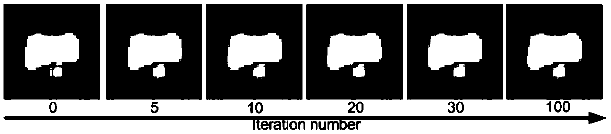 Automatic tumor image region segmentation method based on improved level set