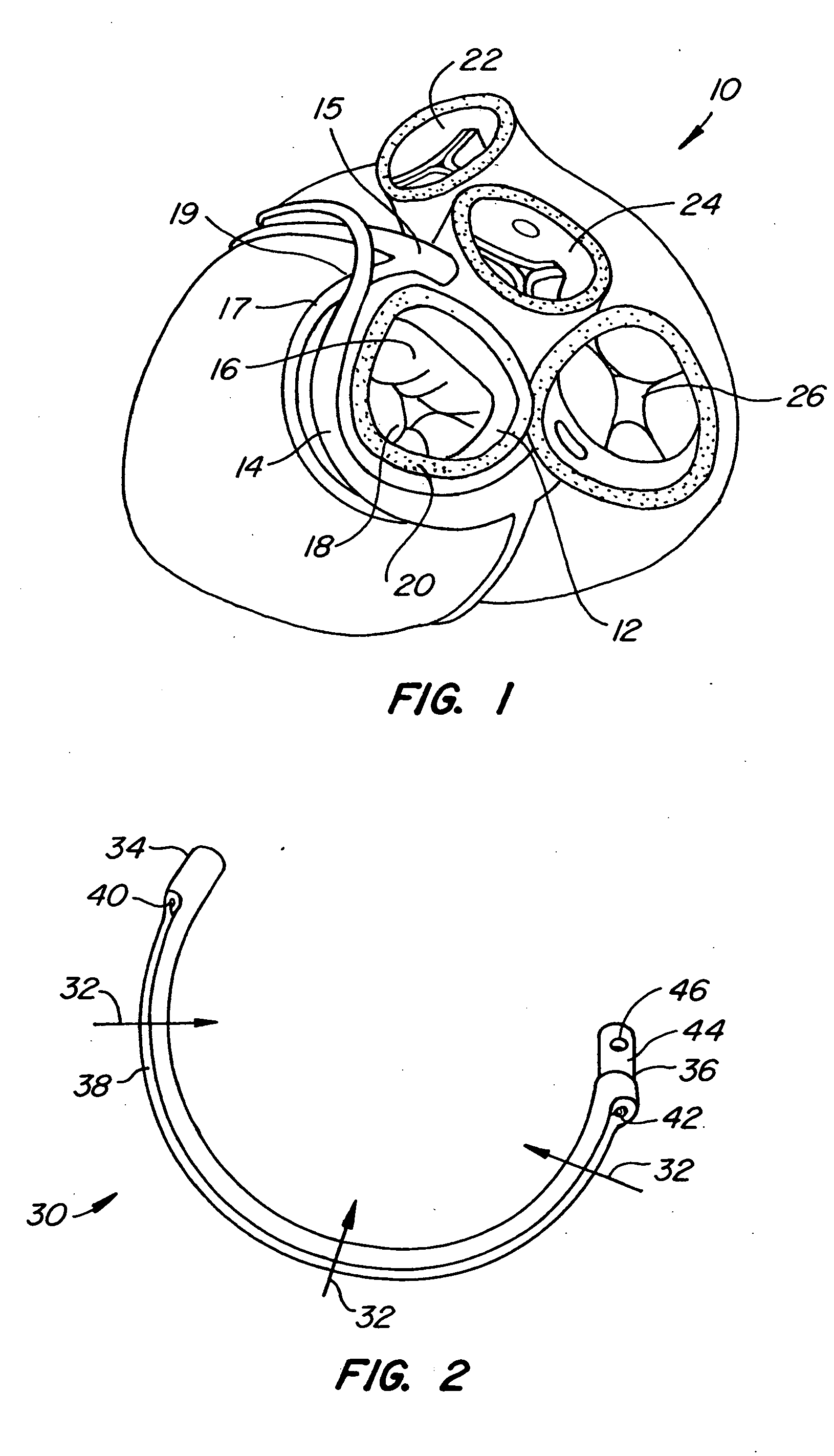 Mitral valve therapy device, system and method