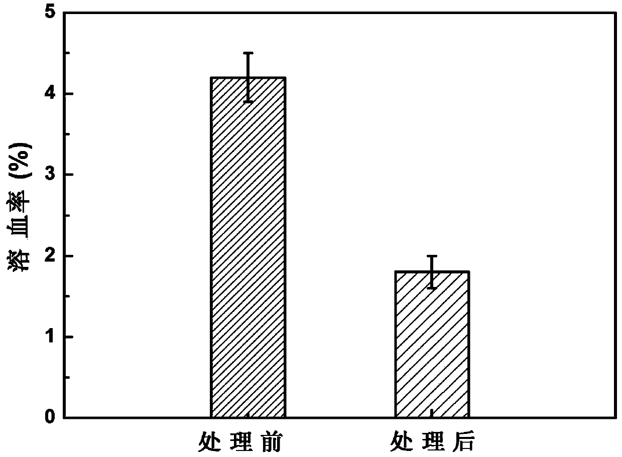 Method for carrying out surface modification upon biodegradable magnesium and magnesium alloy through iron ion implantation deposition