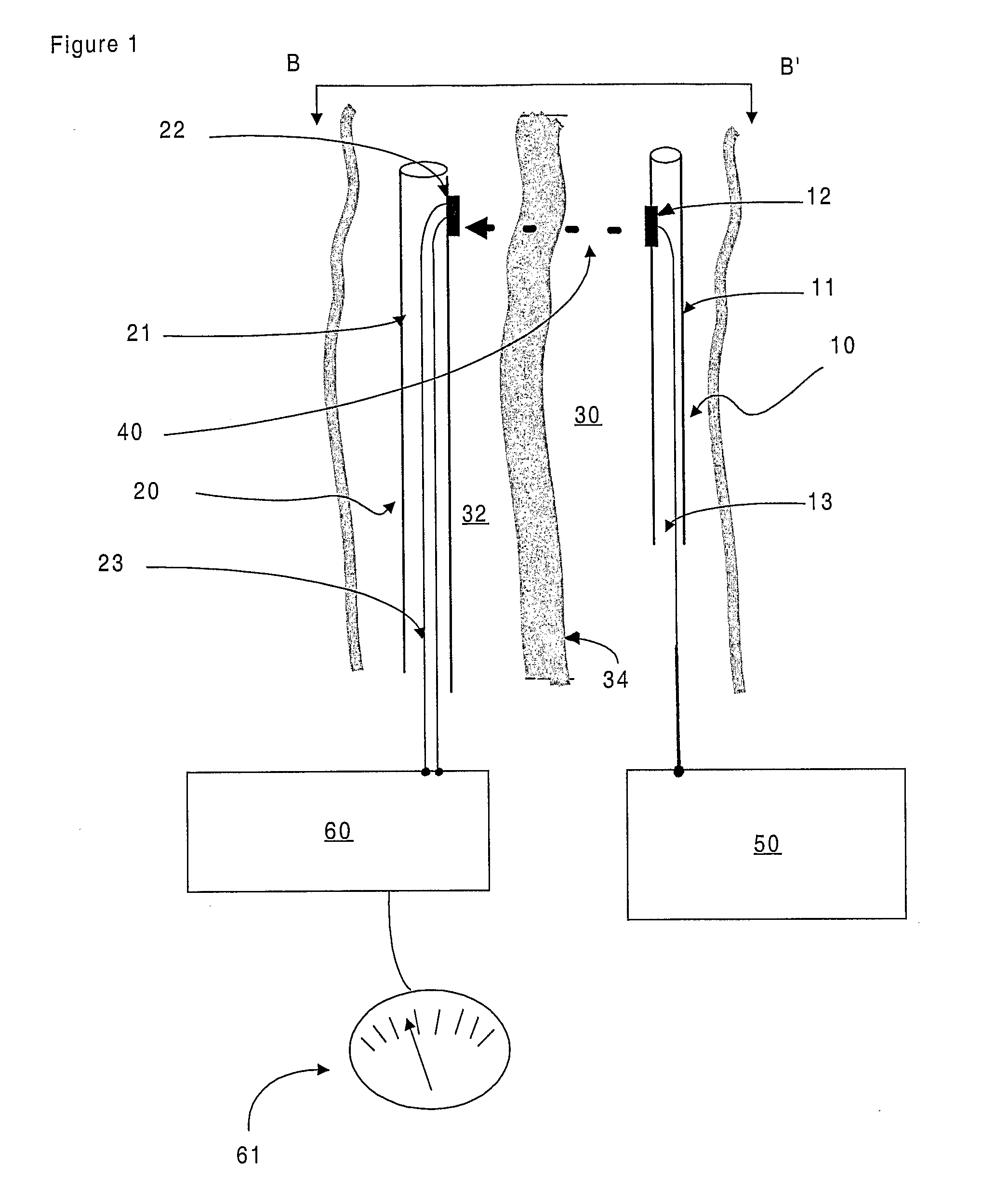 Minimally Invasive Surgical Appartus and Methods