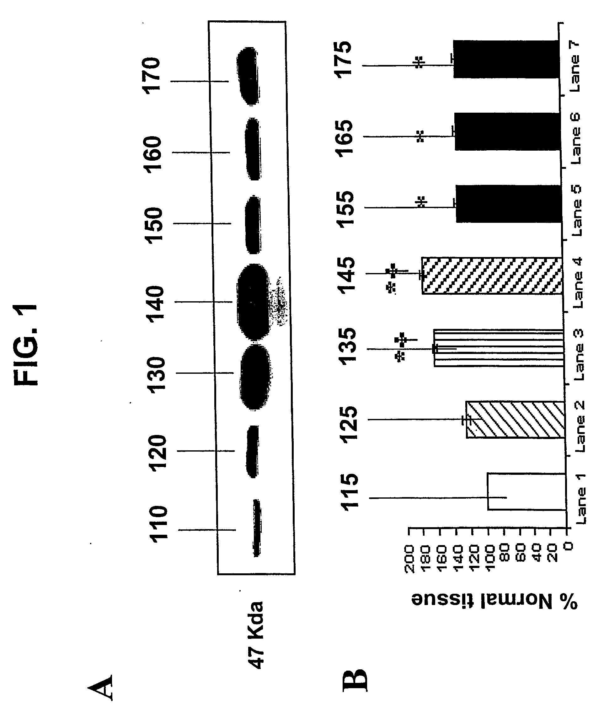 Compositions and methods for use of a protease inhibitor and adenosine for preventing organ ischemia and reperfusion injury