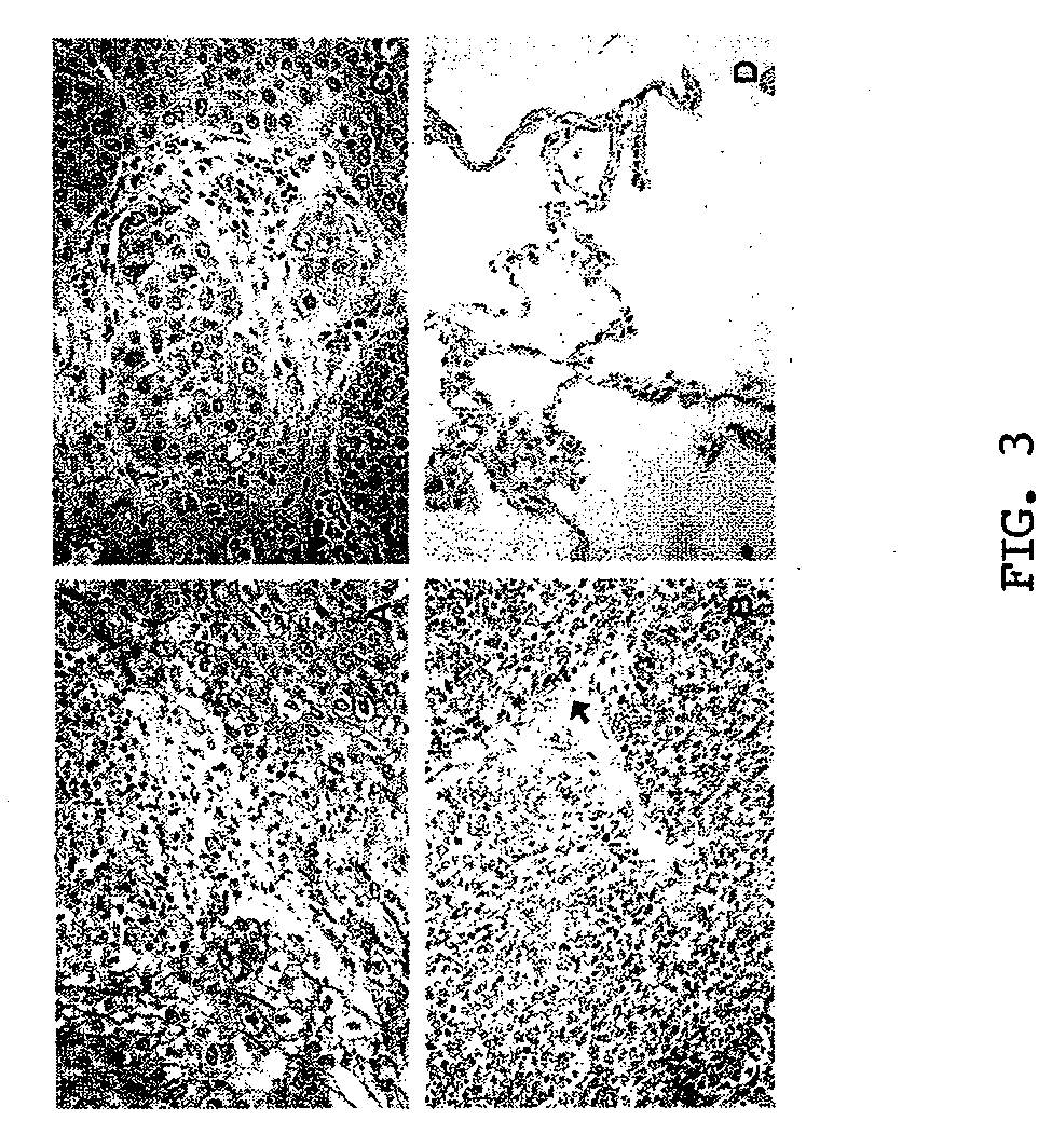 Targeting of notch3 receptor function for cancer therapy