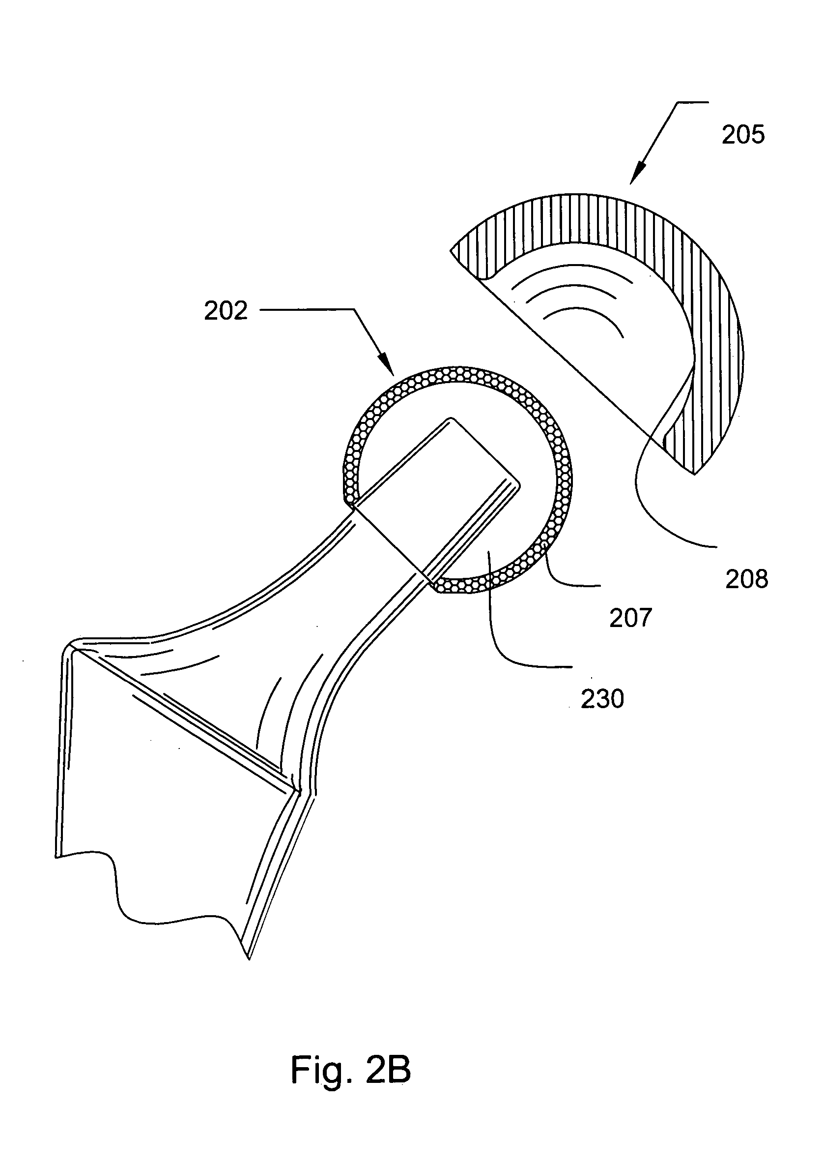 Prosthetic knee joint having at least one diamond articulation surface