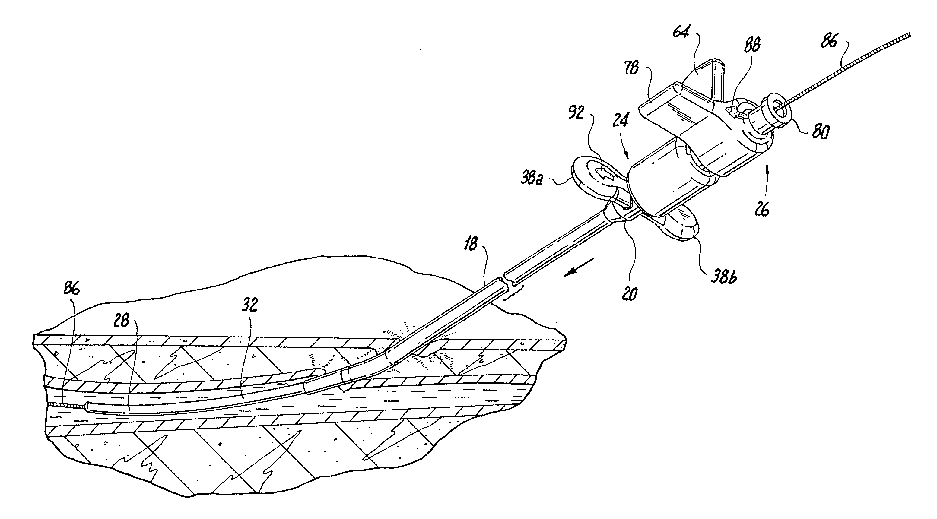 Vascular introducer having hemostatic valve with integral seal