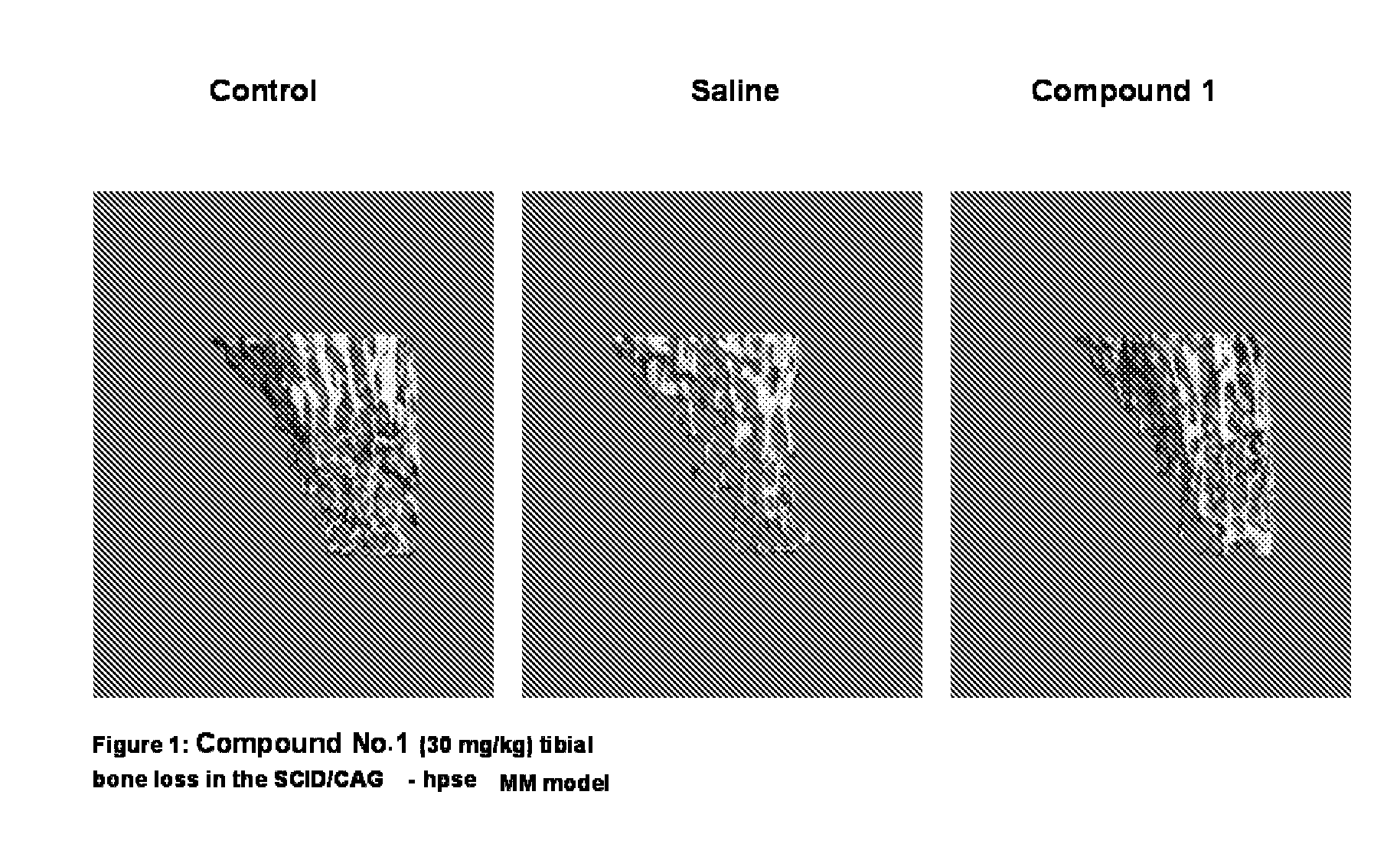 Compounds, Compositions and Methods for the Treatment of Diseases Through Inhibiting TGF- Activity