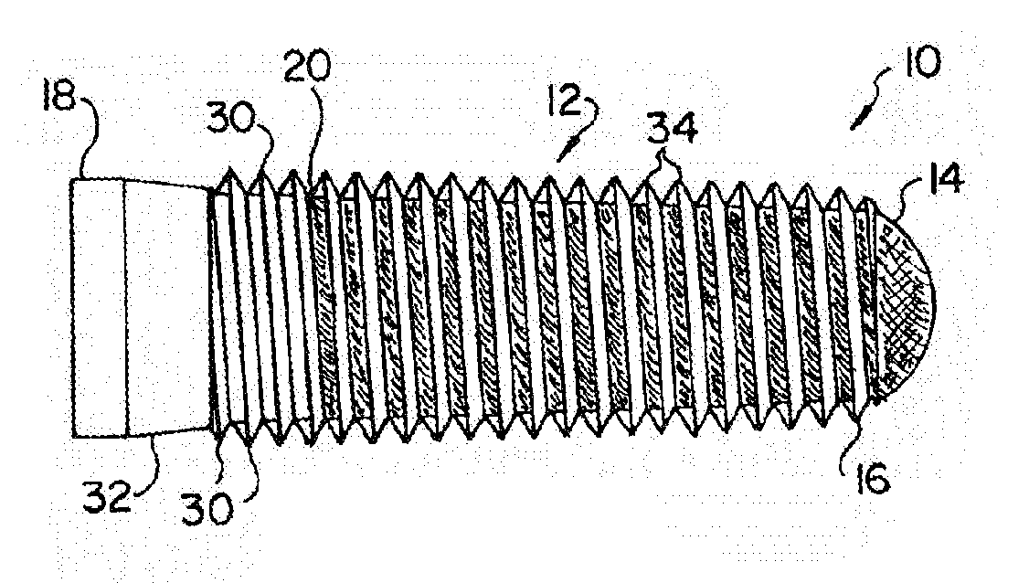 Porous implant with non-porous threads