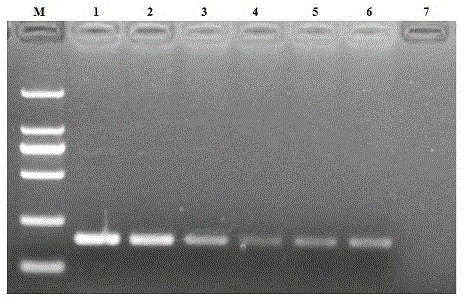 Reverse transcription loop-mediated isothermal amplification kit for swine epidemic encephalitis B virus and application of kit