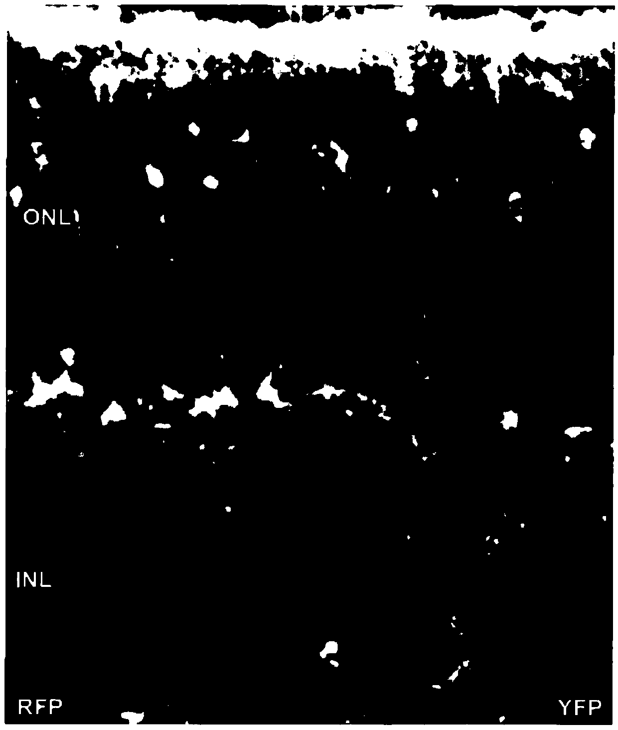 Methods Of Treatment Of Retinal Degeneration Diseases