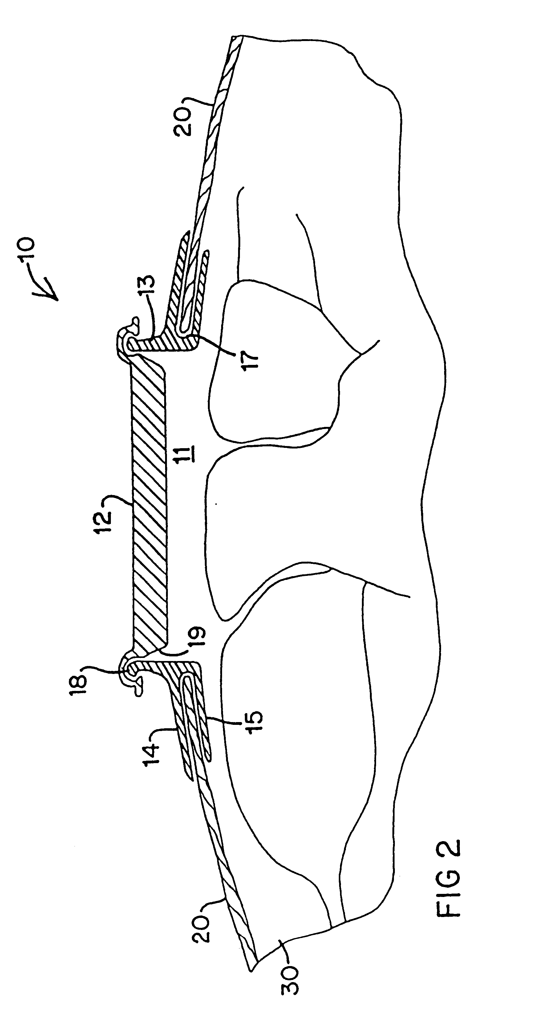 Modified trocar and methods of use