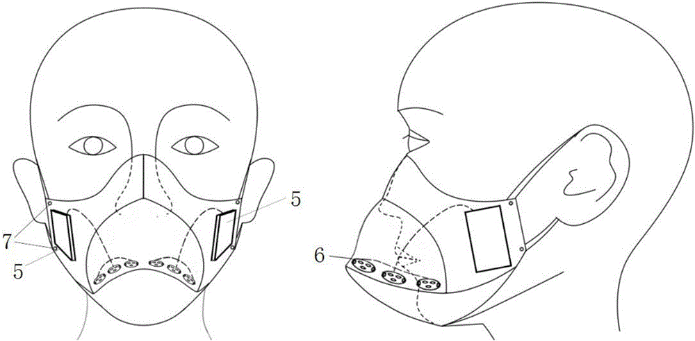 Chronic respiratory diseases treatment mask with keeping warm and moisture function