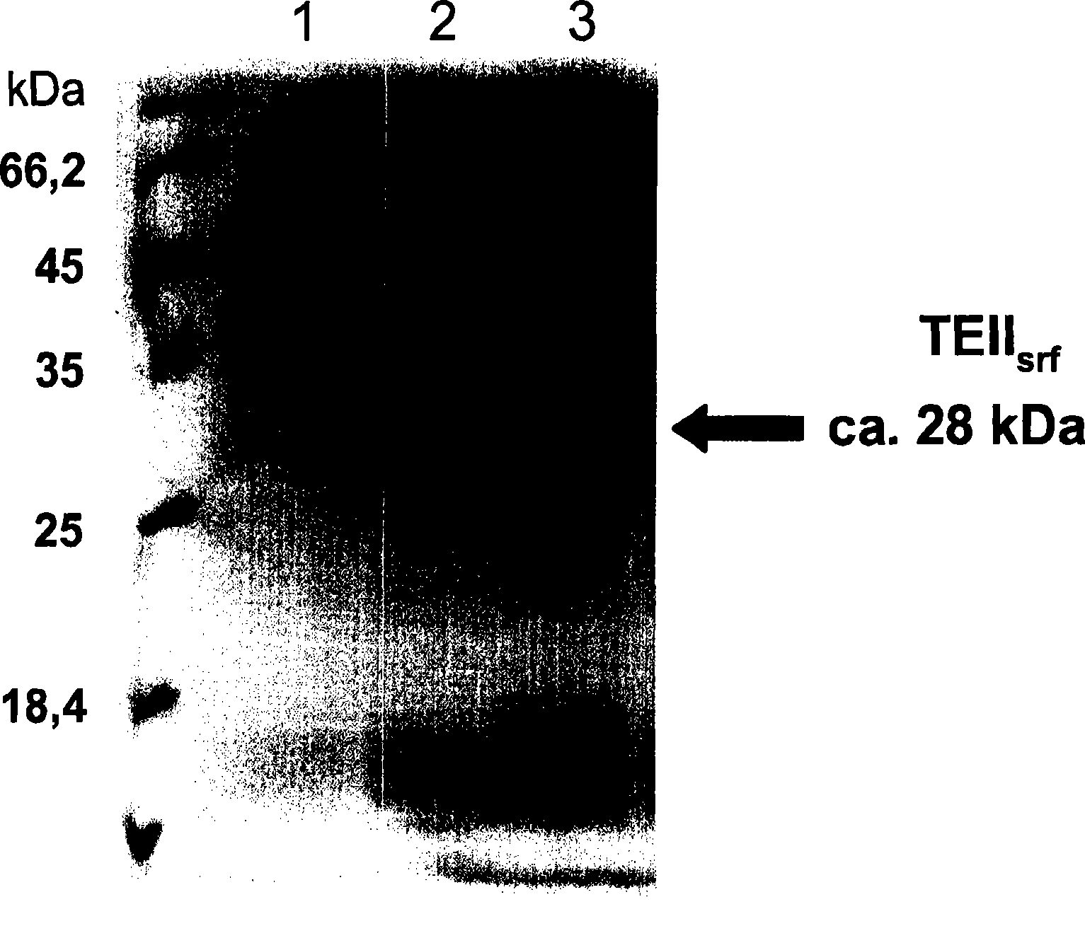 Fermentative production of acetone from renewable resources by means of novel metabolic pathway