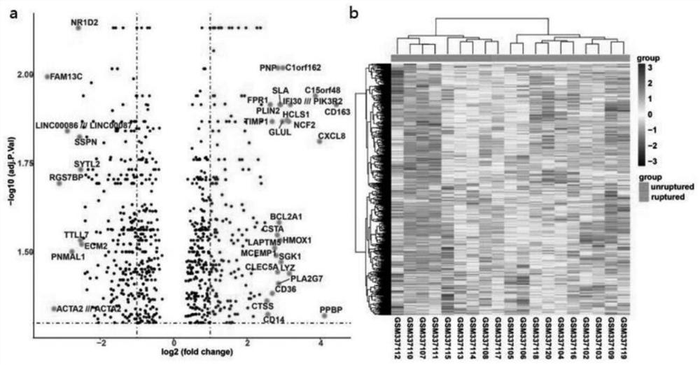 Research method for key genes of intracranial aneurysm formation and rupture