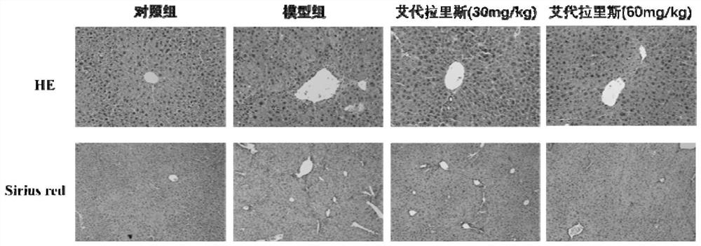 Application of idelalisib in preparation of medicine for treating hepatic fibrosis diseases