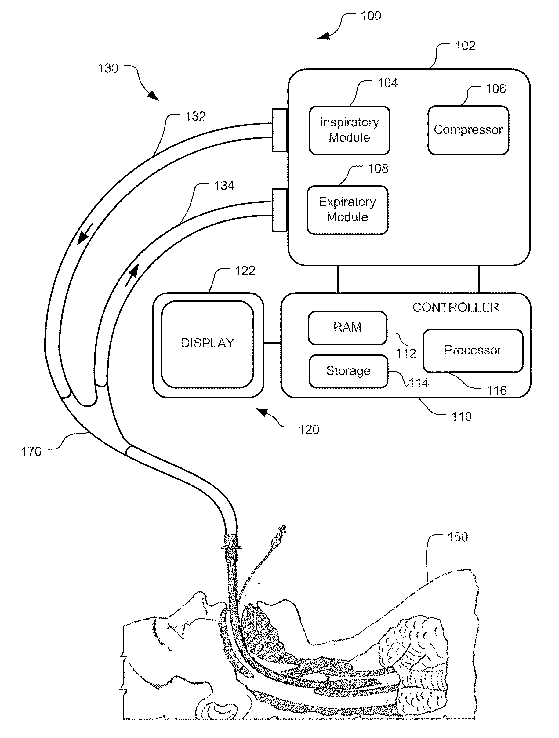 Display And Access To Settings On A Ventilator Graphical User Interface