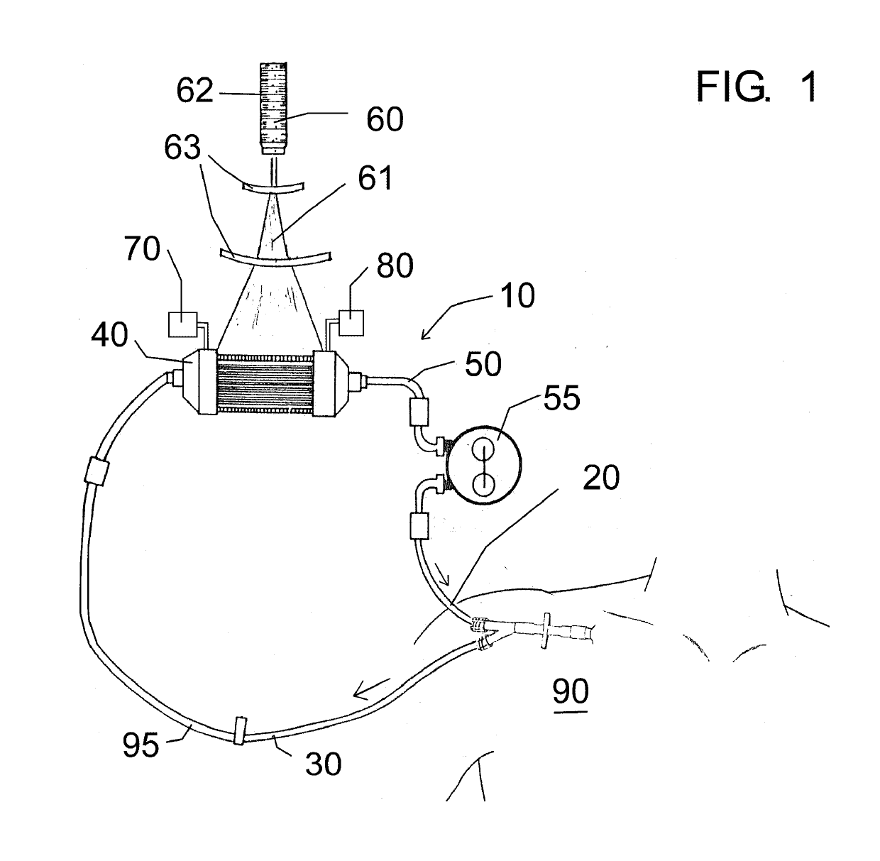 Extracorporeal photodynamic blood illumination (irradiation) for the treatment of carbon monoxide poisoning