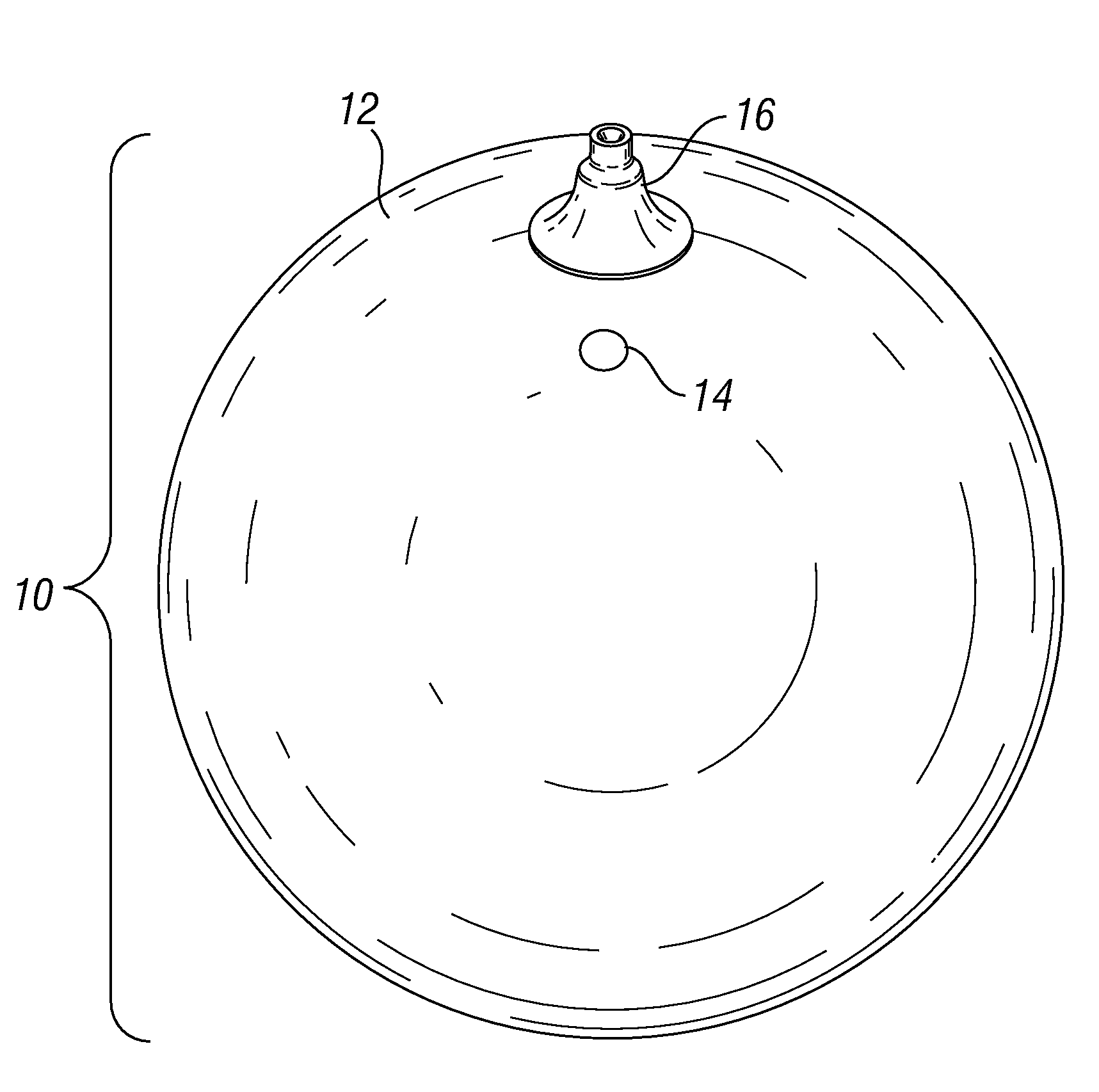 Pressure sensing intragastric balloon