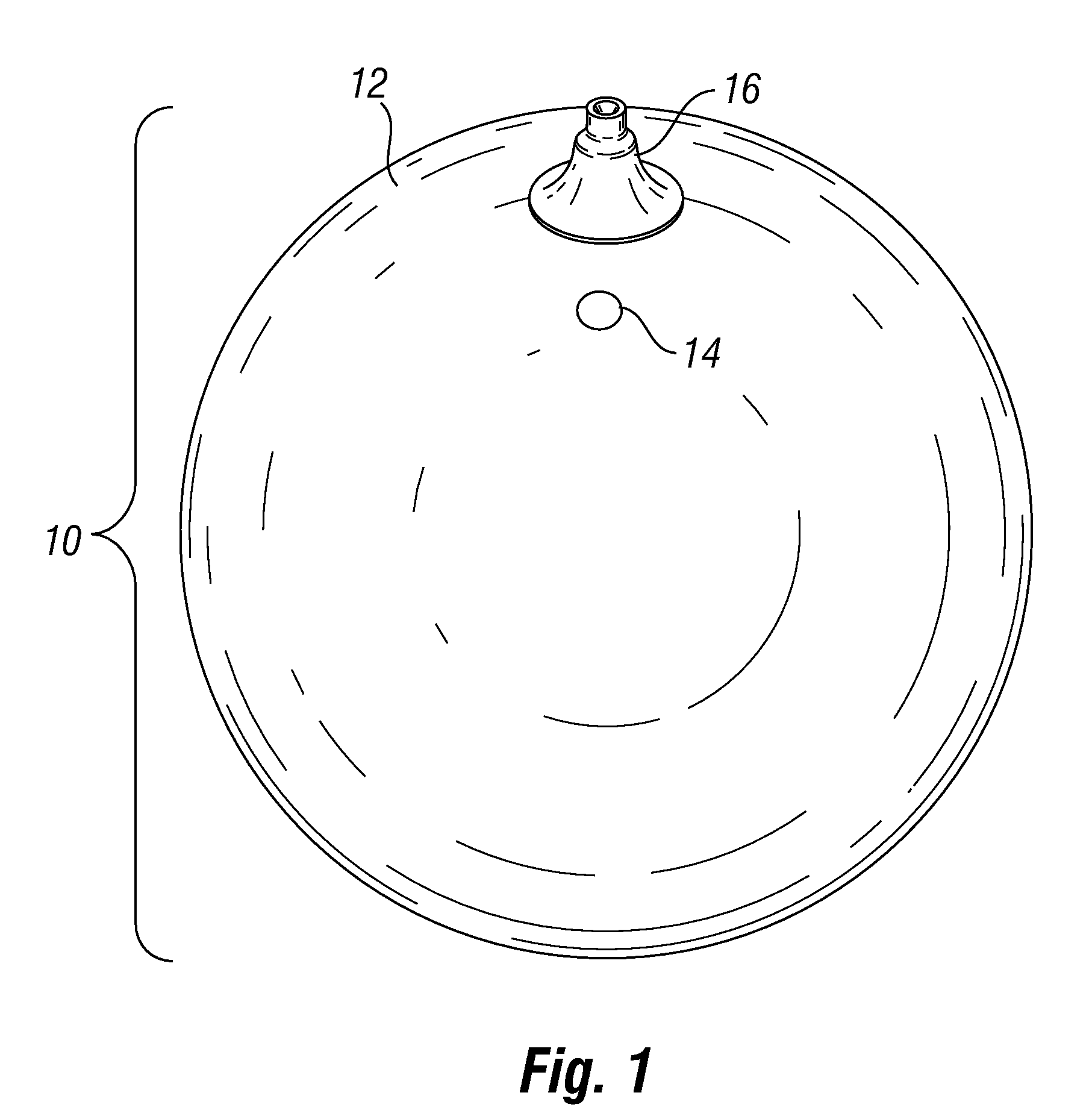 Pressure sensing intragastric balloon