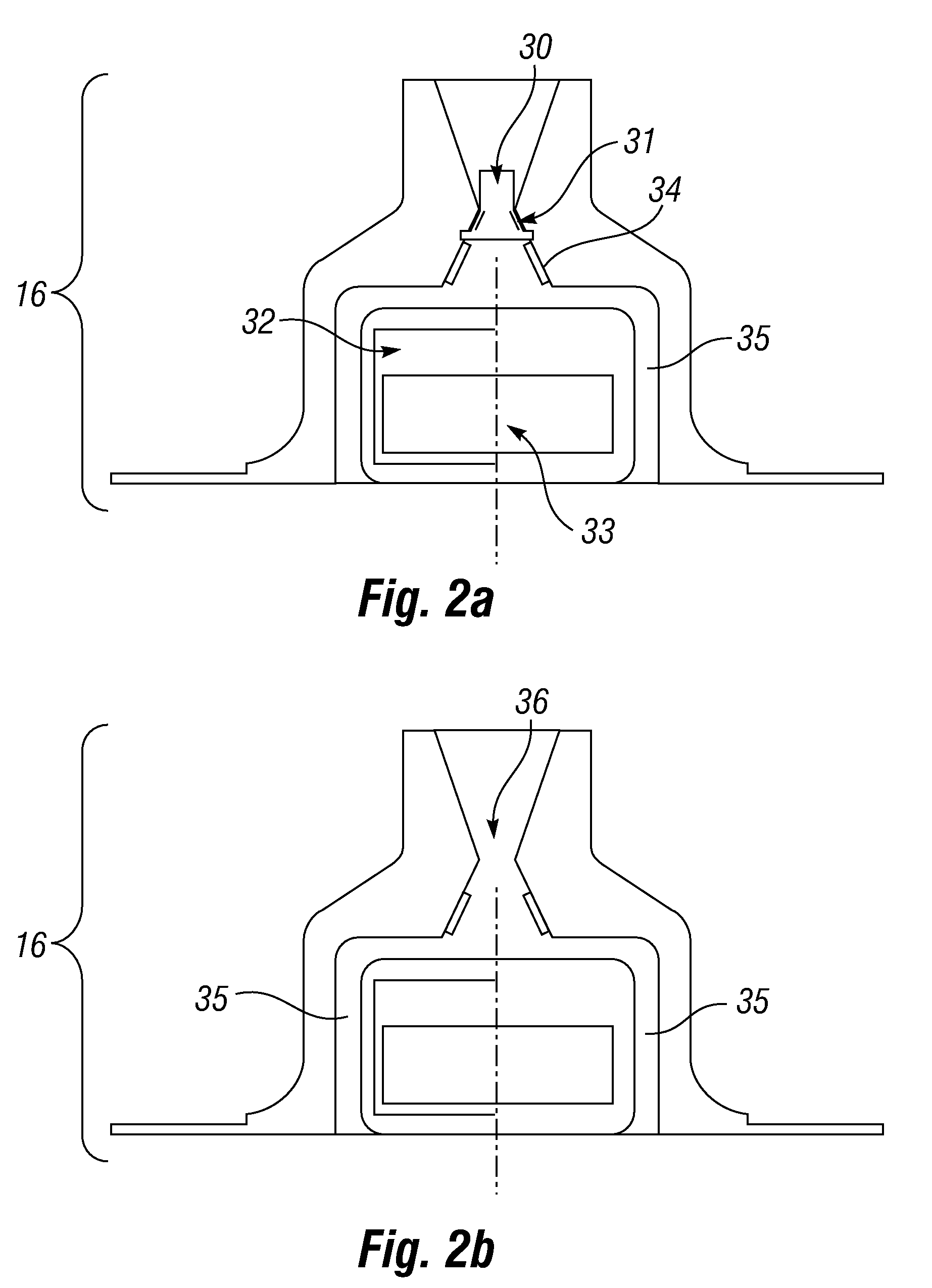 Pressure sensing intragastric balloon