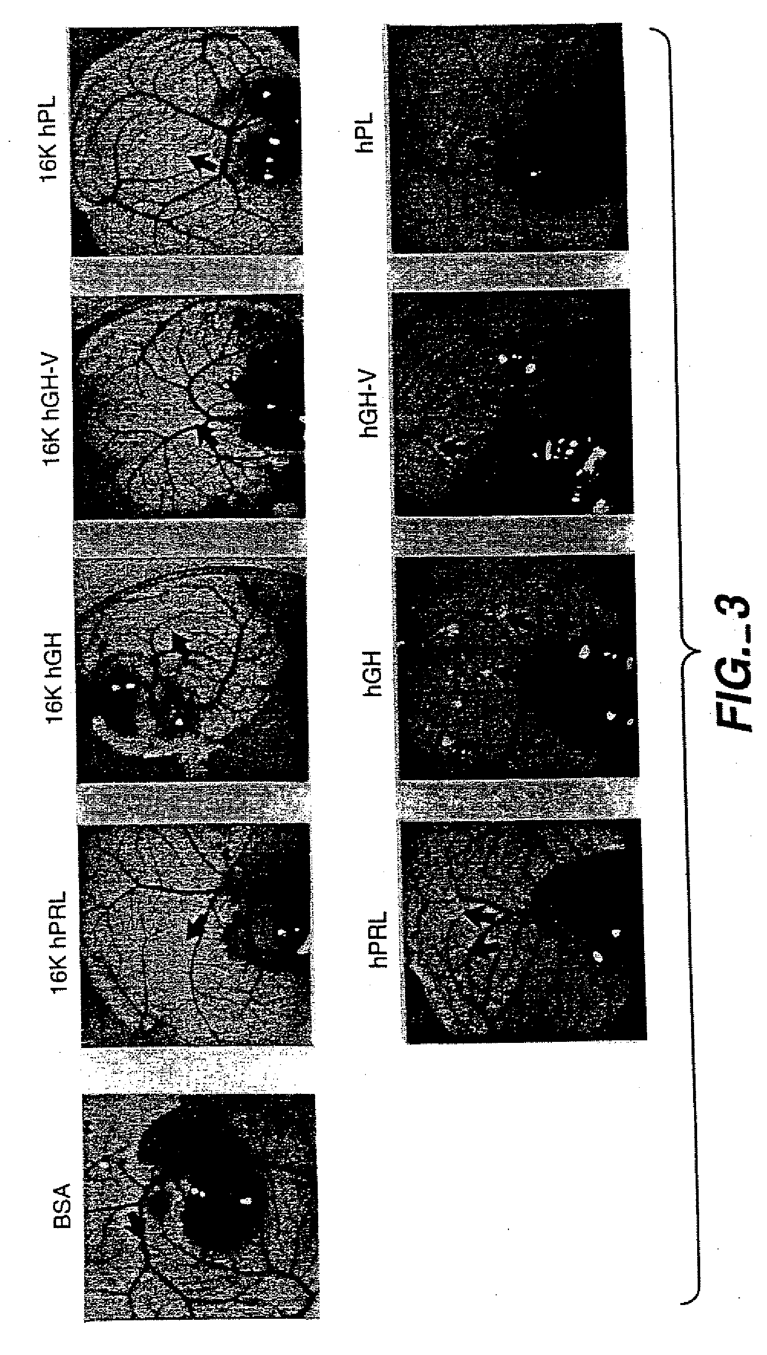 Novel Antiangiogenic Peptide Agents and Their Therapeutic and Diagnostic Use