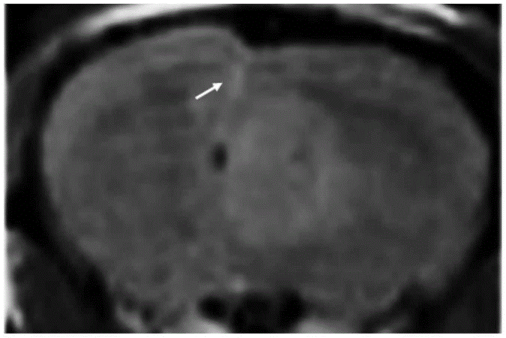 IL-13 modified gadolinium chelate containing liposome targeted magnetic resonance imaging contrast agent and preparation method and application thereof