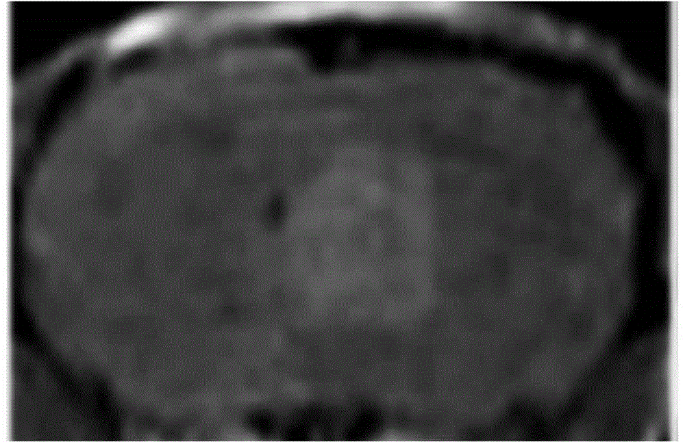 IL-13 modified gadolinium chelate containing liposome targeted magnetic resonance imaging contrast agent and preparation method and application thereof