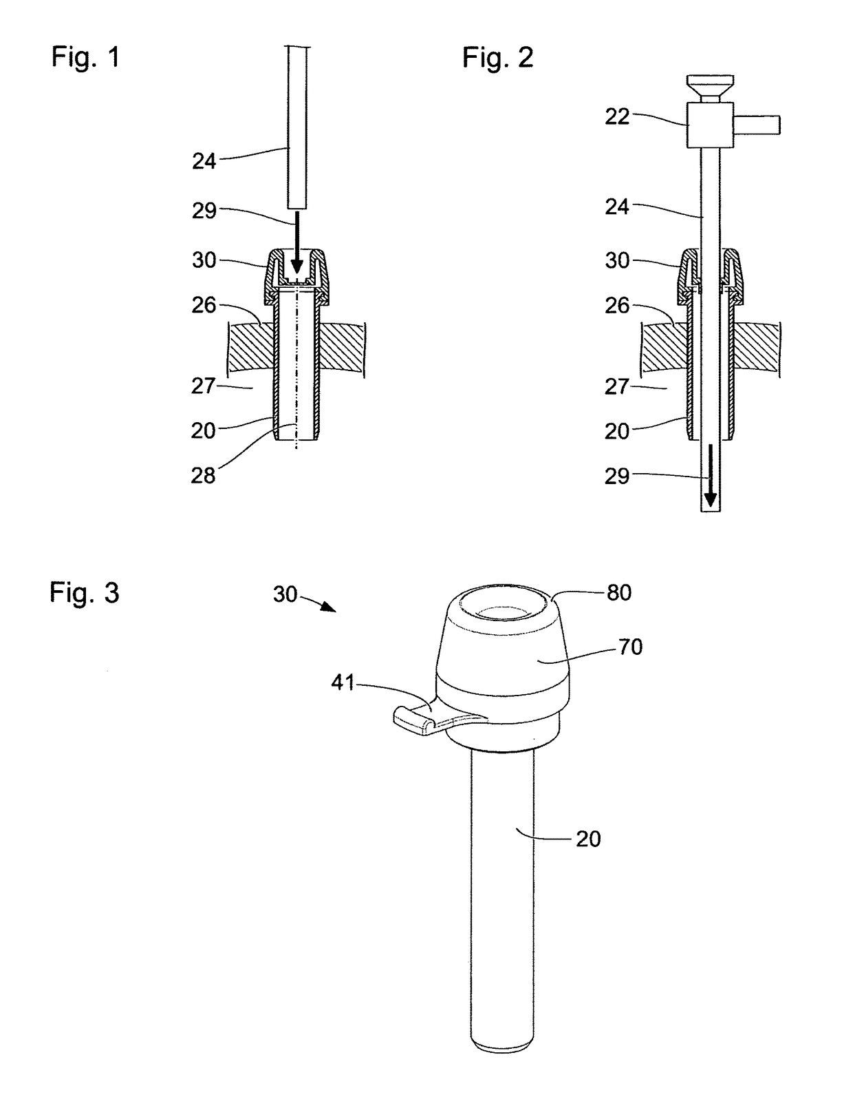 Sealing device for sealing a passage for a medical instrument