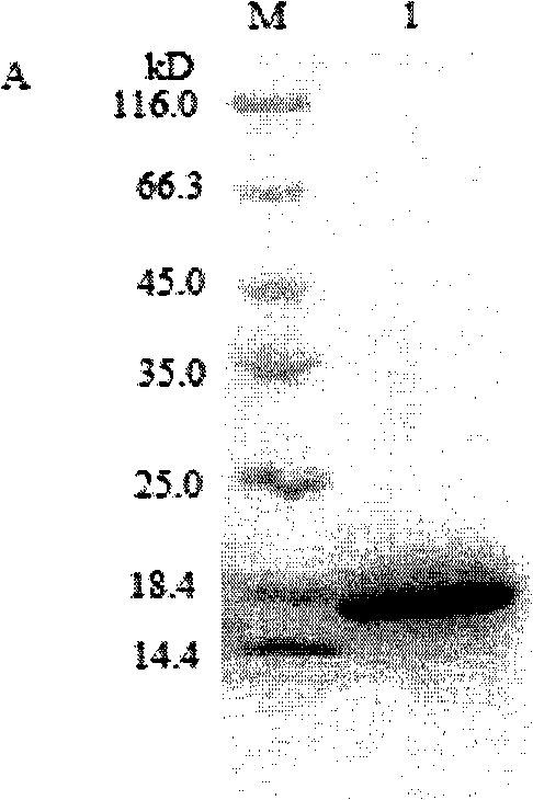 Human adiponectin enzyme-linked immunosorbent detection kit, preparation method and application thereof