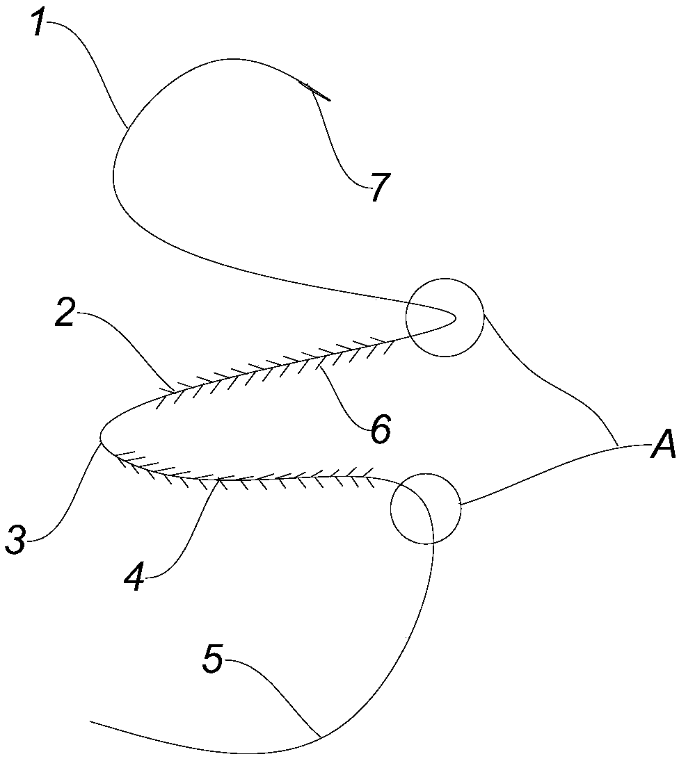 Lifting beauty line implanted into wound surface