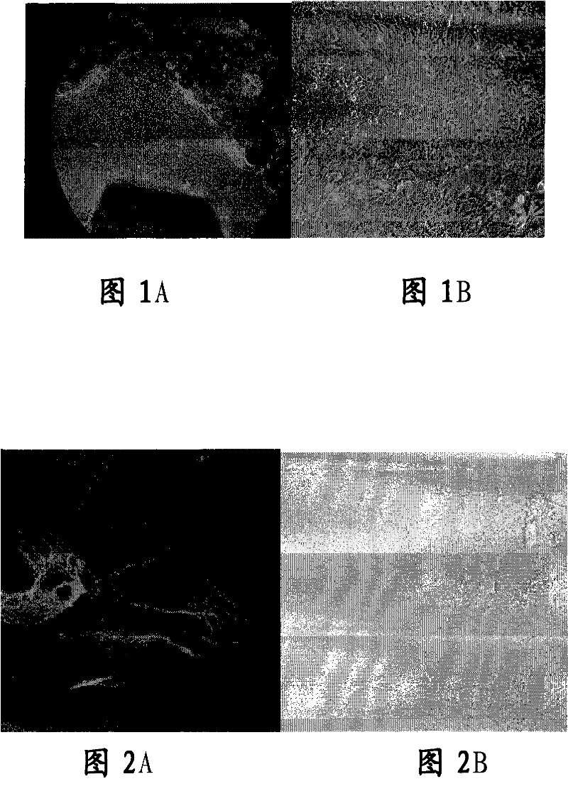 Tissue engineered cornea epithelial transplantation membrane and preparation method and use thereof