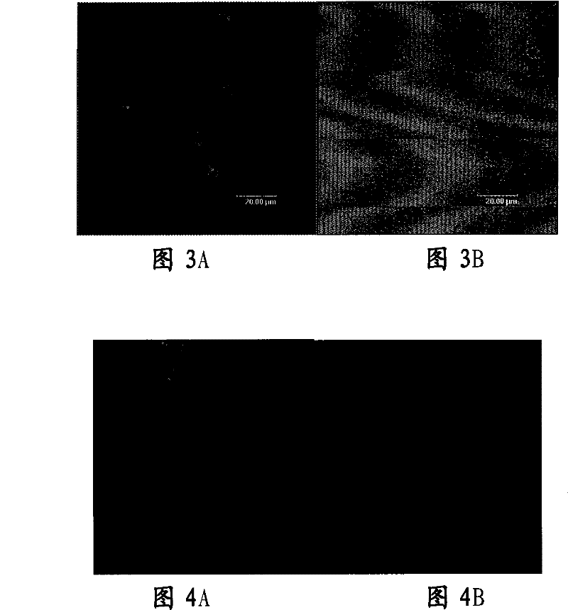 Tissue engineered cornea epithelial transplantation membrane and preparation method and use thereof