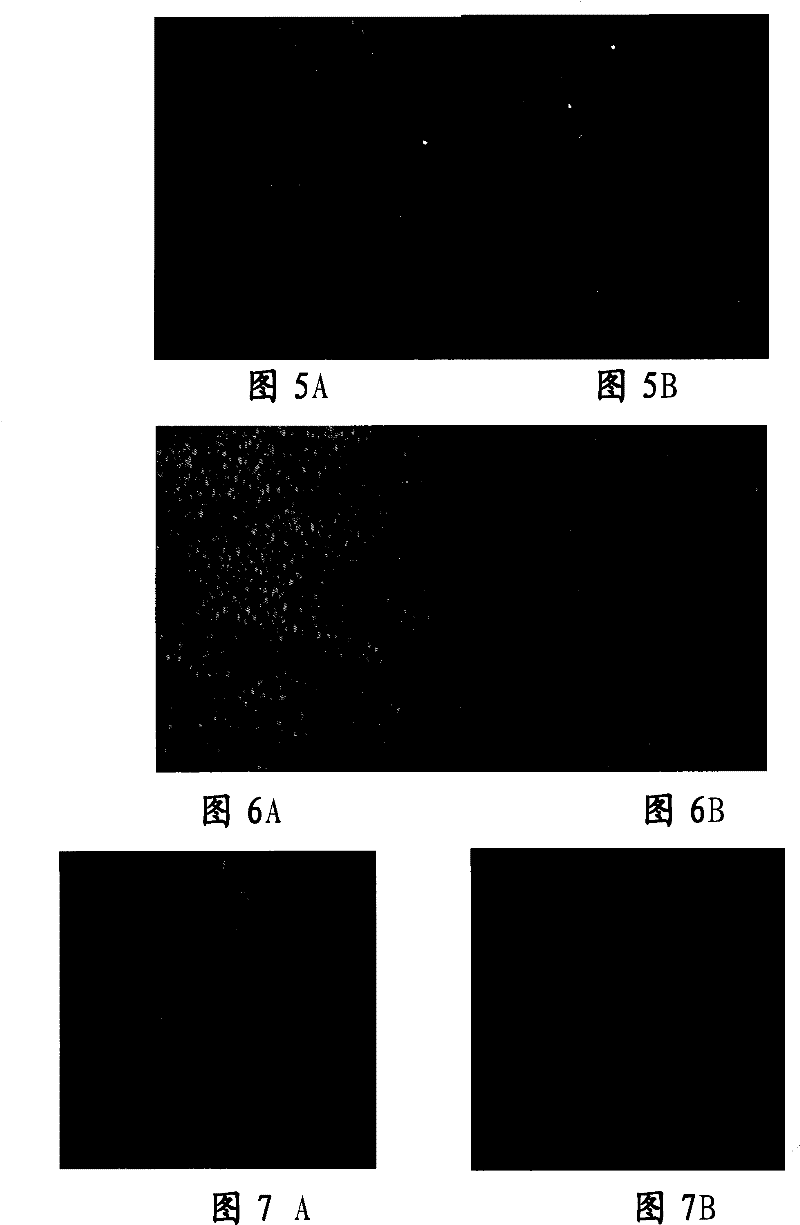 Tissue engineered cornea epithelial transplantation membrane and preparation method and use thereof