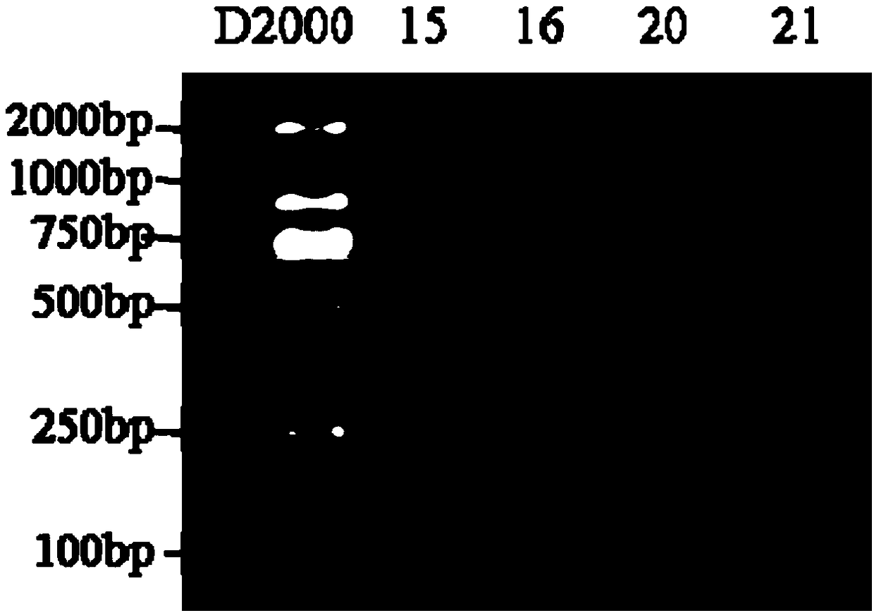 Method and detection kit used for nasal cavity flora detection