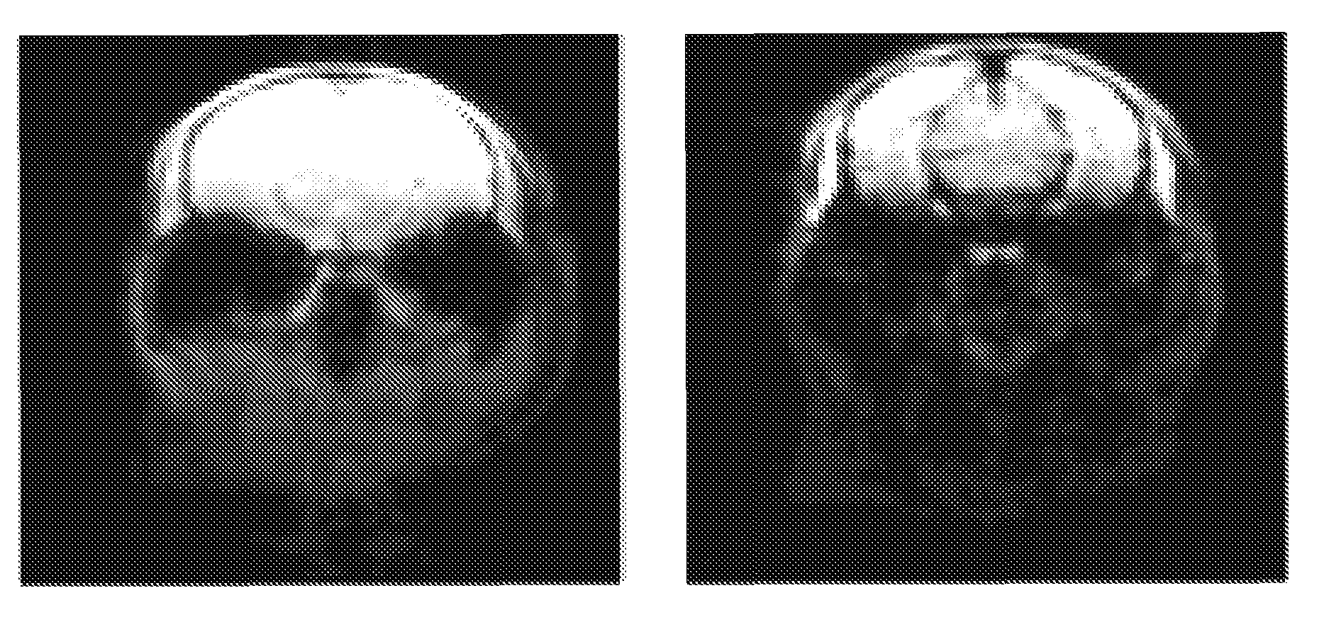 Method for Opening Tight Junctions