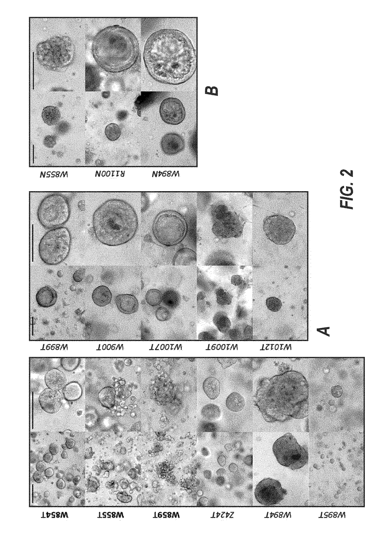 Culture medium for expanding breast epithelial stem cells