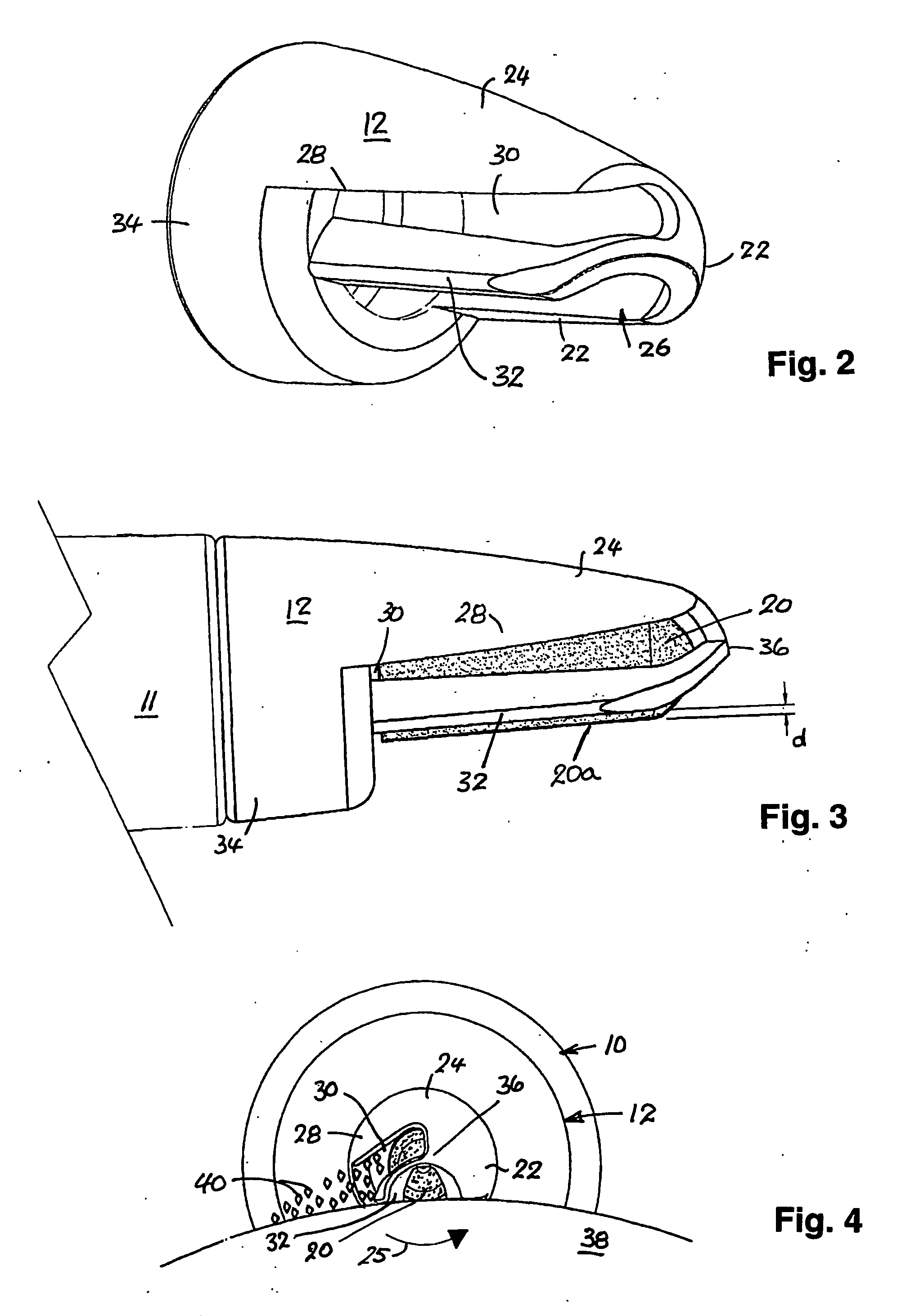 Method and apparatus for treating skin