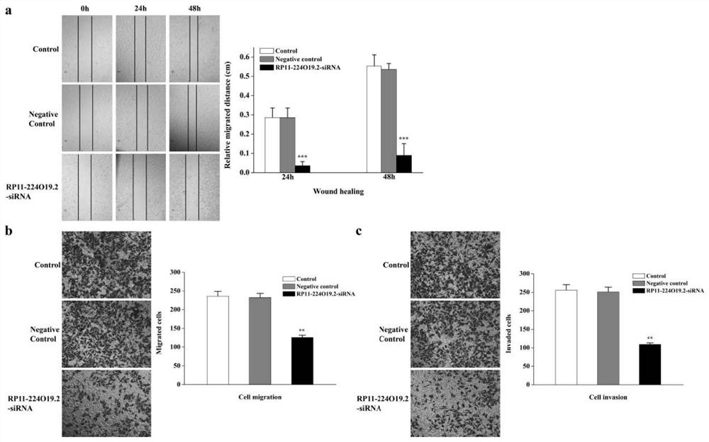 Use of long-chain non-coding rna RP11-224O19.2 inhibitors