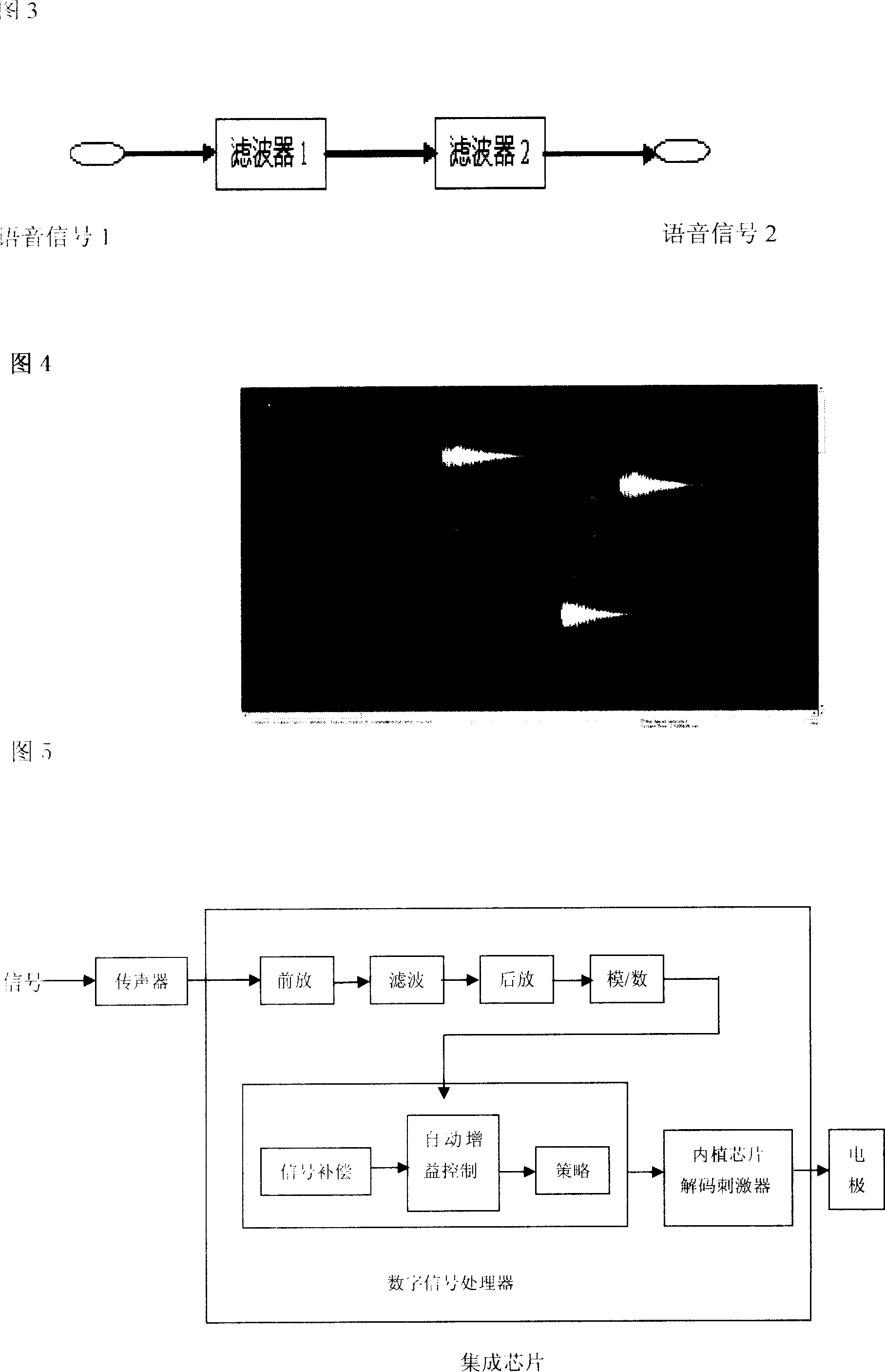 Full-implanting type artificial cochlea and method for making same